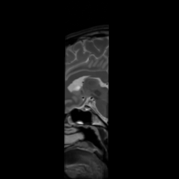 MRI Template - T2 Sagittal View